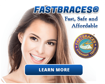 Fastbraces Services In Fairfax