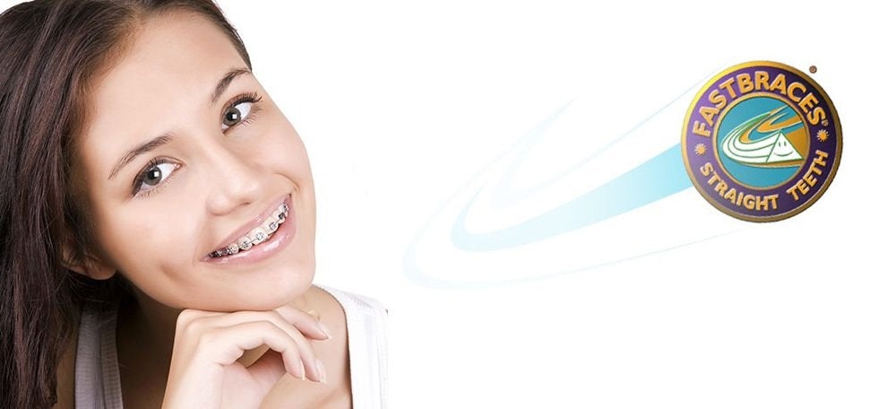 Fastbraces Orthodontic Treatment  in Fairfax, VA
