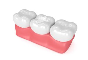 3D visualization of teeth with composite filling at Fair City Mall Dental Care, Fairfax, VA.